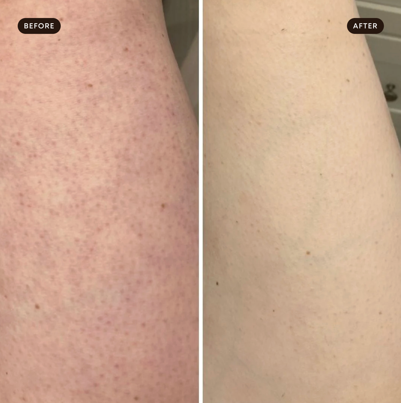 Clinic-grade skin results